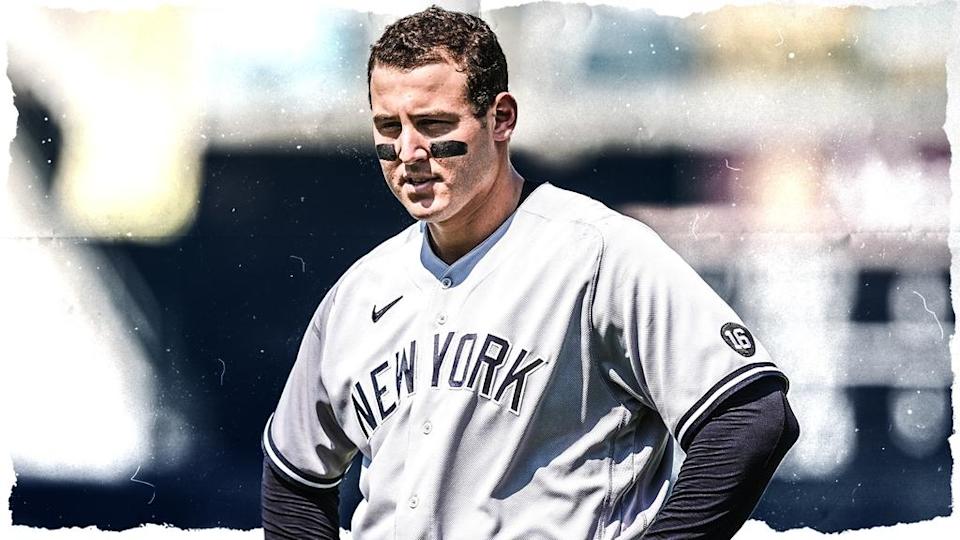 Anthony Rizzo treated image, grey uniform with no hat or helmet and hands on hips