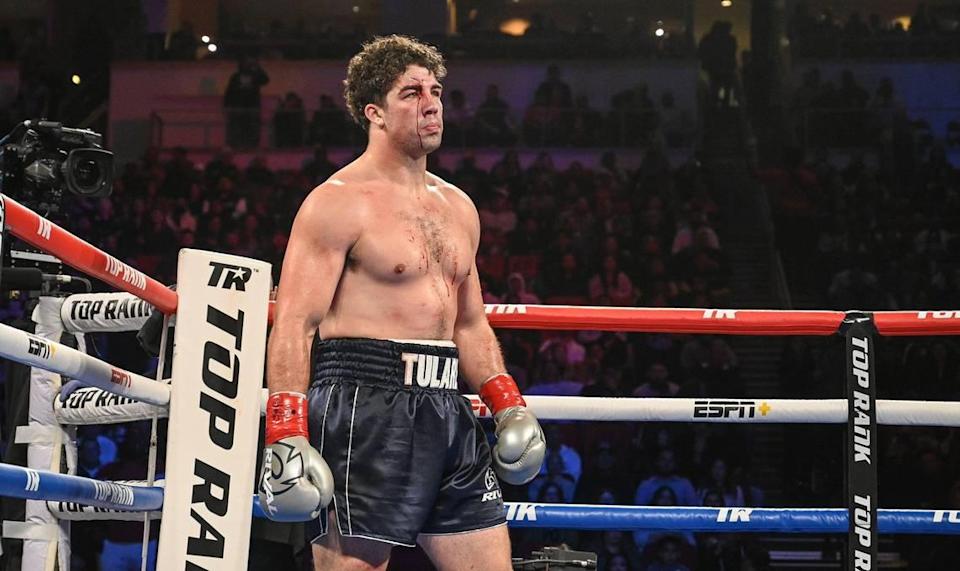 Richard Torrez Jr, gets ready for round two against Allen Melson during their fight at the Save Mart Center on Friday, March 4, 2022.