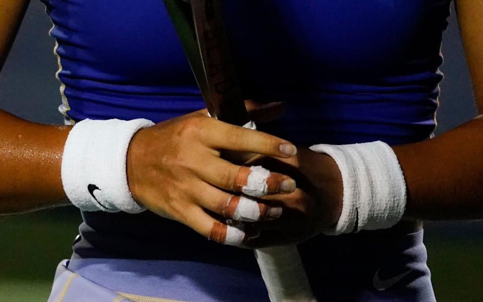 Raducanu's blistered fingers were heavily taped - EPA