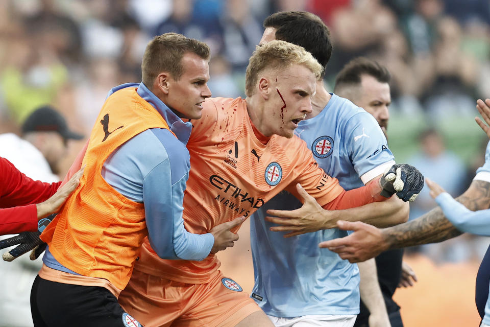 MELBOURNE, AUSTRALIA - DECEMBER 17: A bleeding Tom Glover of Melbourne City is escorted from the pitch by team mates after fans stormed the pitch during the round eight A-League Men's match between Melbourne City and Melbourne Victory at AAMI Park, on December 17, 2022, in Melbourne, Australia. (Photo by Darrian Traynor/Getty Images)